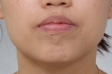 부산교정치과추천