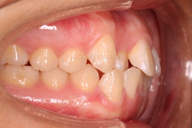 사직동교정치과