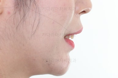 부산교정치과