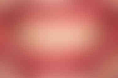 부산사랑니교정