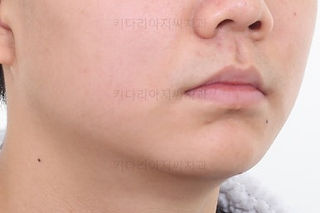 부산청소년교정