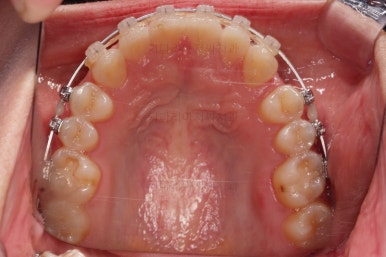 부산교정치과추천