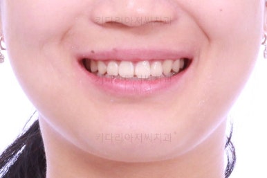 부산치아교정치과