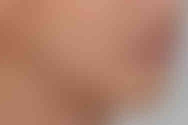 부산왜소치교정