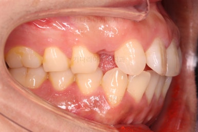 연산동교정치과