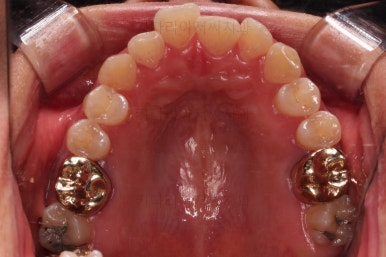 부산안면비대칭