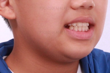 부산어린이교정