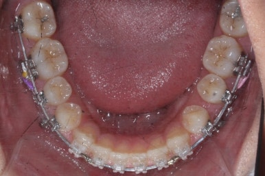 부산치아교정치과