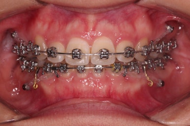 사직동교정치과