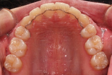 사직동교정치과