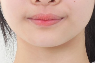 연산동교정치과