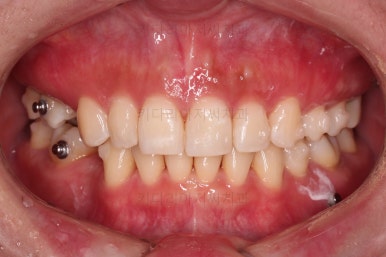 부산인비절라인