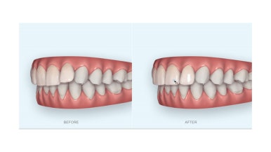 연산동부분교정