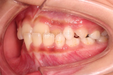 부산어린이교정