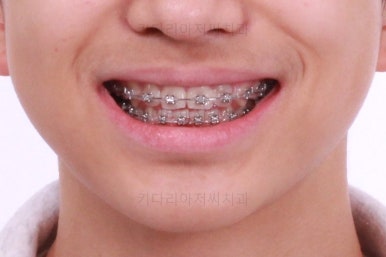 부산교정치과추천