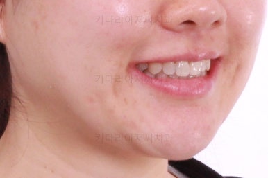 부산인비절라인