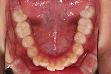 부산치아교정치과