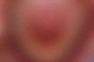 부산교정치과추천