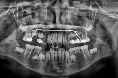 부산어린이교정