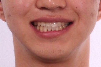 연산동교정전문치과