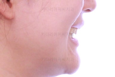 부산인비절라인