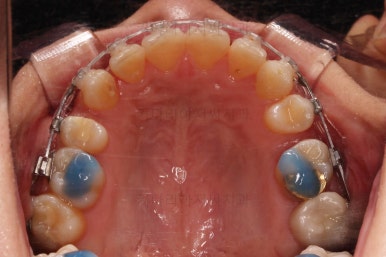 연산동교정치과