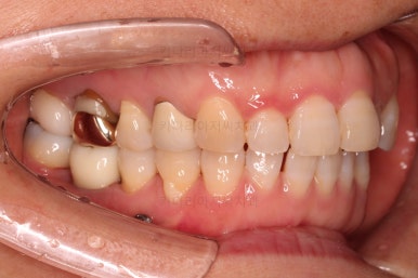 연산동부분교정