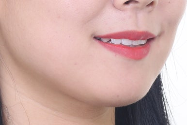 부산연산동교정치과