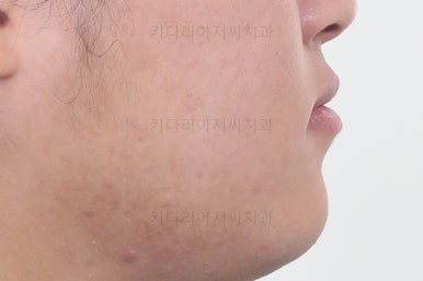 연산동교정