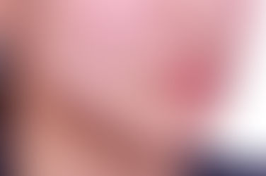 부산치아교정잘하는곳