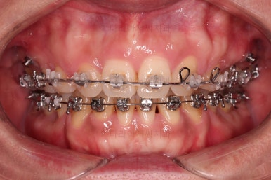 연산동교정치과