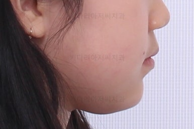 부산초등학생교정