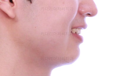 부산연제구교정