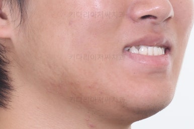 연산동교정