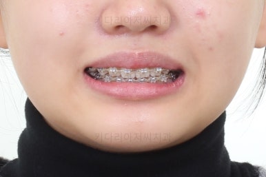 부산교정전문의