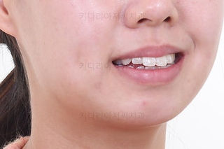 부산치아교정잘하는치과