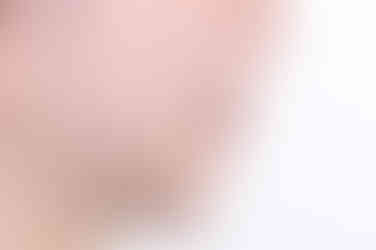 부산연산동교정치과