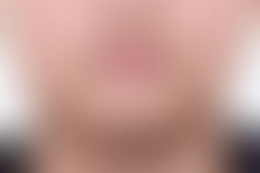 부산성장기교정