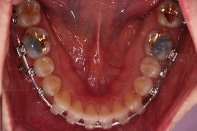 부산연산동치과