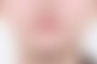 부산덧니교정