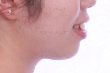 부산교정전문치과