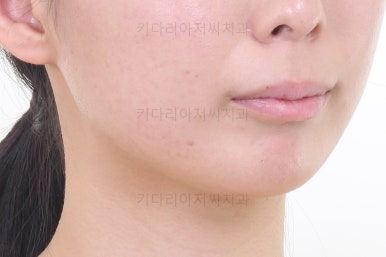 부산무턱교정치과