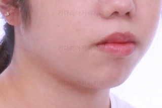 부산교정전문치과