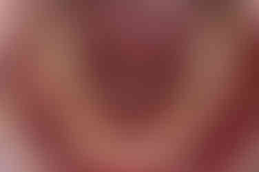 부산비발치교정