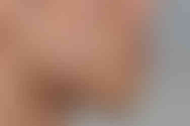 부산주걱턱교정