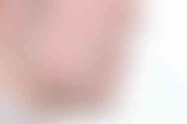 부산임플란트교정