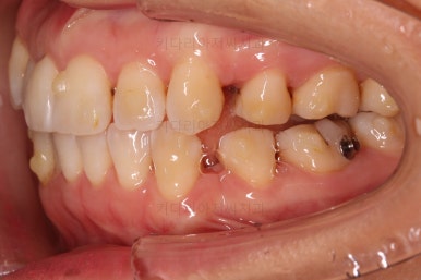 부산인비절라인