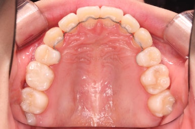 부산교정전문의