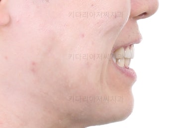 부산교정치과