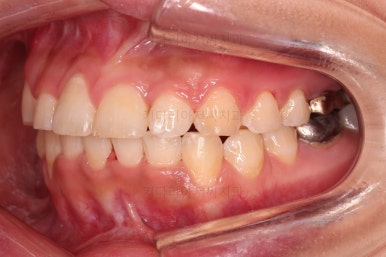 부산안면비대칭